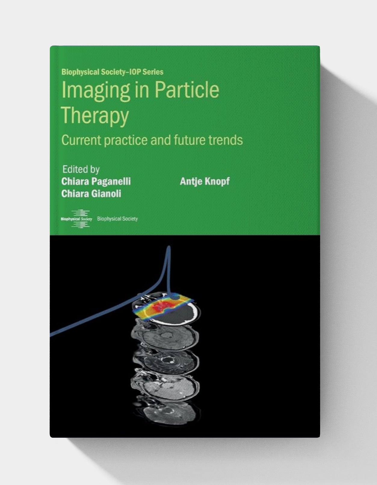 Imaging in Particle Therapy: Current practice and future trends