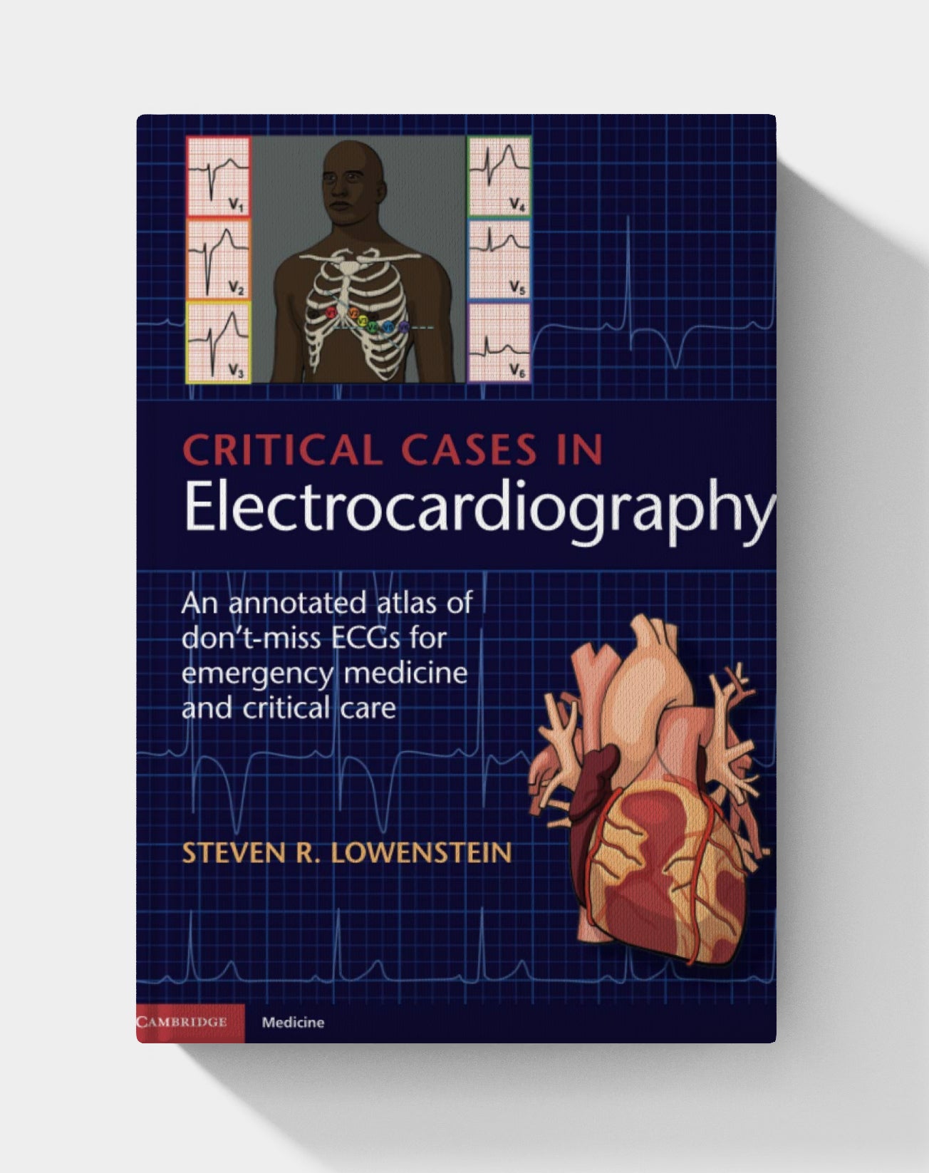 Critical Cases in Electrocardiography: An Annotated Atlas of Don't-Miss ECGs for Emergency Medicine and Critical Care