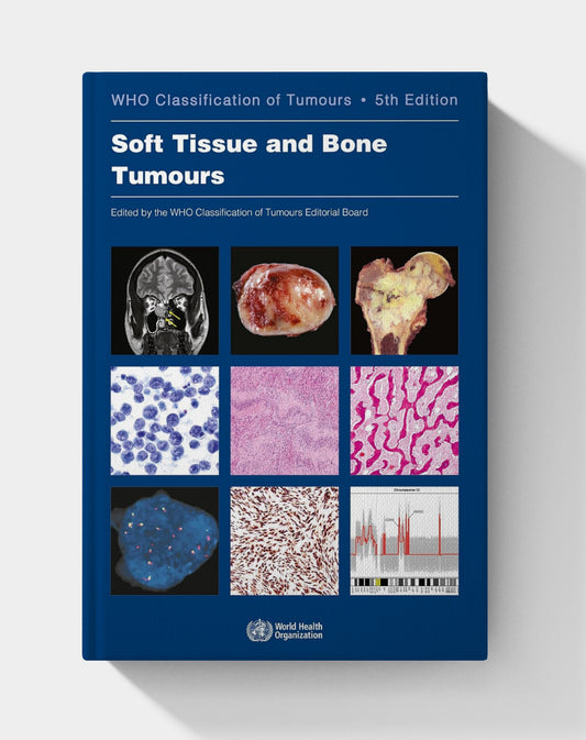Soft Tissue and Bone Tumours: WHO Classification of Tumours (Medicine) 5th Edition