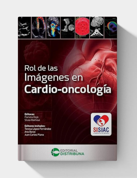 Rol de las imágenes en cardio-oncología (Spanish Edition) (EPUB)