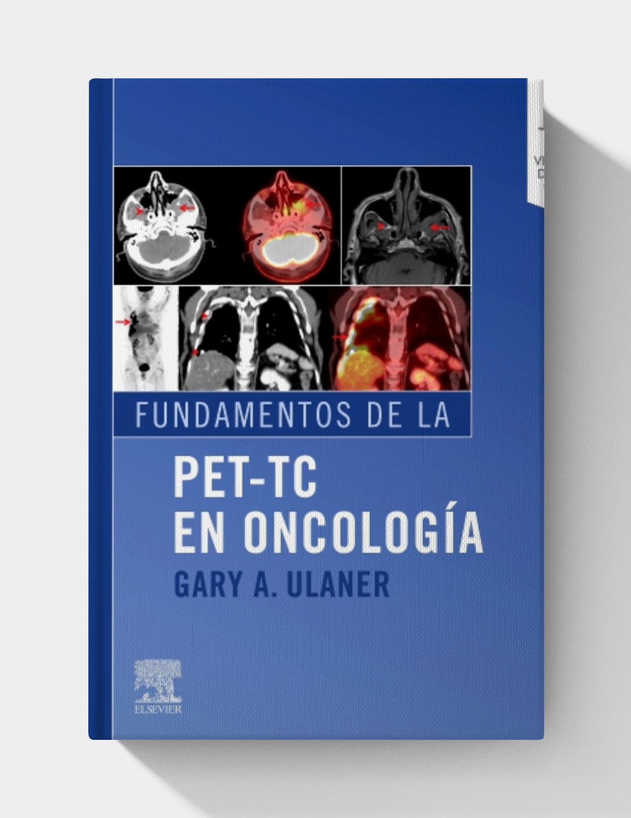 Fundamentos de la PET-TC en oncología (Spanish Edition)