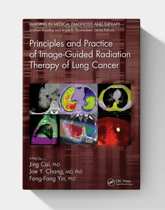 Principles and Practice of Image-Guided Radiation Therapy of Lung Cancer