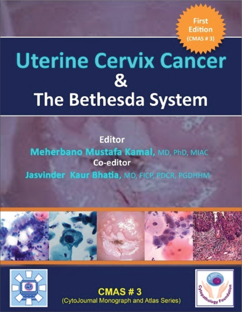 Uterine Cervix Cancer The Bethesda System: CMAS # 3 (CytoJournal Monograph / Atlas Series)