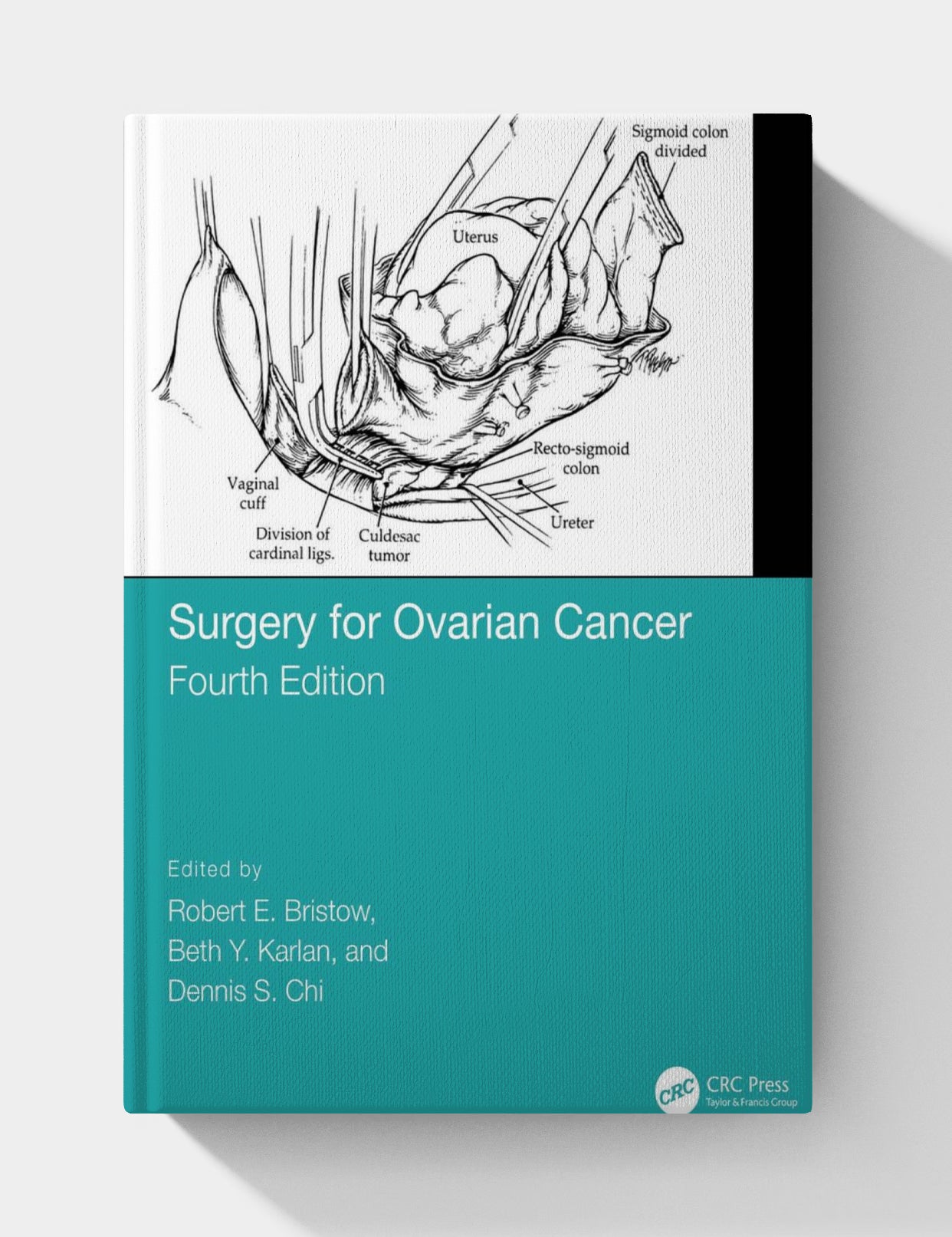Surgery for Ovarian Cancer, 4th Edition